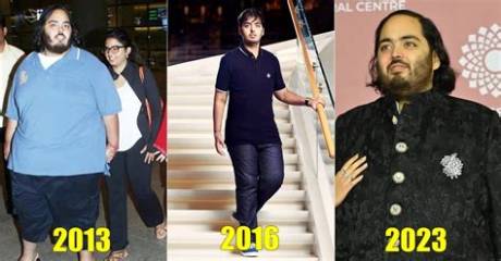 Anant Ambani's Health Journey: Understanding His Illness
