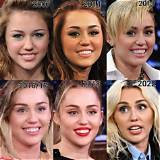 Did Miley Cyrus Get Plastic Surgery