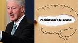 Exploring Parkinson's Speculations Surrounding Paul Gosar