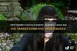 Pete Burns Is He Transgender? Transformative Procedures and Gender and Sexuality