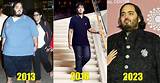 The Unspoken Truth: Anant Ambani's Health Unveiled
